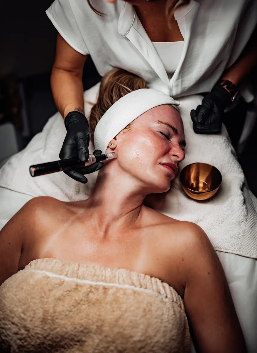 Heather performing microneedling along a client's cheek in Tucson