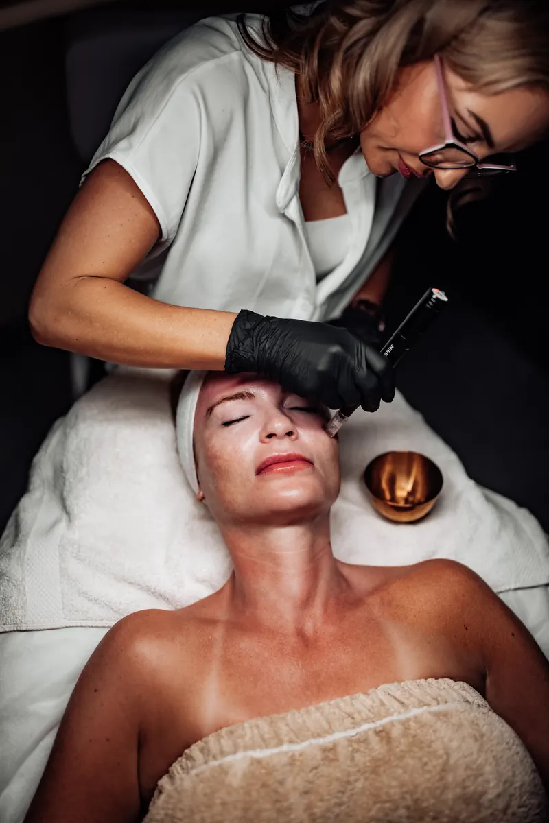 Microneedling device applied carefully to a client's forehead in Tucson