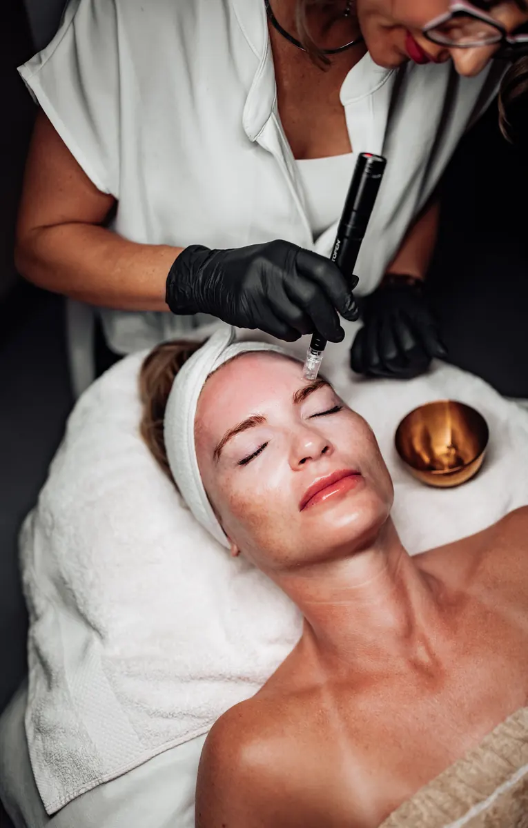 Professional facial microneedling treatment at Heather's Tucson studio